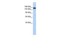 Synaptojanin 1 antibody, N-term