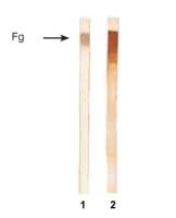 Fibrinogen antibody [1F3]