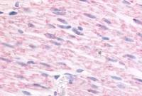 alpha 2c Adrenergic Receptor antibody