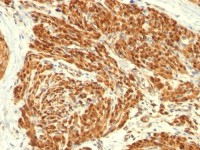 Calponin 1 antibody [CALP]