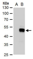 SOX18 antibody
