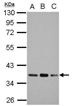 Pyruvate Dehydrogenase E1 beta subunit antibody