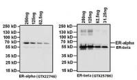 Estrogen Receptor alpha antibody [33]