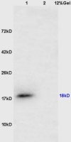 CTAG1B antibody