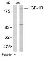 IGF1R antibody