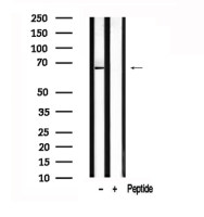 USP22 antibody