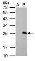 RGS17 antibody [C2C3], C-term