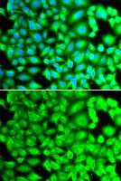 REG III alpha antibody