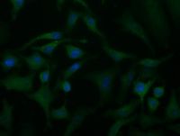 ACAT2 antibody [1C5]