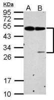 EPCR antibody
