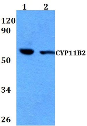 CYP11B2 antibody