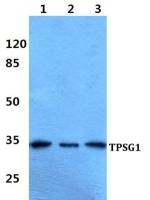 TPSG1 antibody