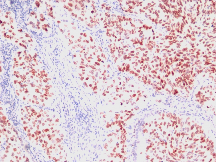 NKX2.1 antibody [SPM150]