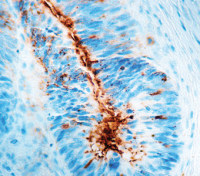 TAG72 antibody [B72-3] (ready-to-use)