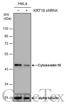 Cytokeratin 18 antibody [N3C3]