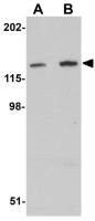 MYBPC2 antibody