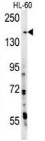 PHLPP2 antibody, N-term
