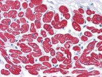 Myosin Light Chain 3 antibody [7C1]