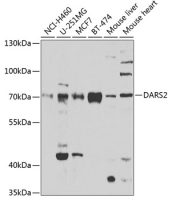 AspRS antibody
