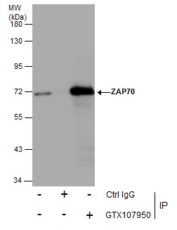 ZAP70 antibody