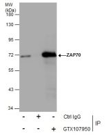 ZAP70 antibody
