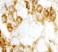 Bombesin Receptor 3 antibody