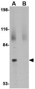 JPH2 antibody