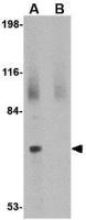 JPH2 antibody