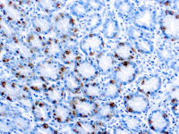 Gastrin antibody