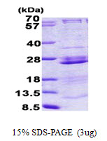 Human RPL23A protein, His tag
