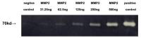 Mouse MMP2 protein, His tag (active)