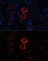 Myosin Heavy Chain 11 antibody
