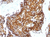 Keratin 77 antibody [KRTL/1577R]