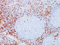 CD8 alpha antibody [C8/144B]