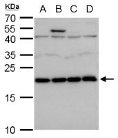 LZIC antibody