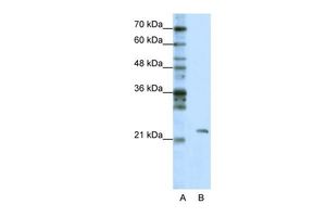 MRM1 antibody, C-term
