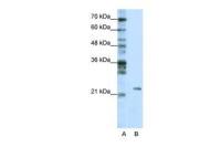 MRM1 antibody, C-term