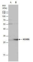 HOXB5 antibody