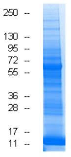 Human Placenta (Normal) tissue lysate