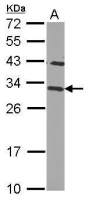 CHMP2B antibody