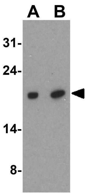 IRGM antibody