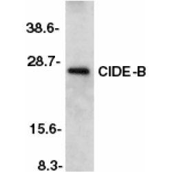 CIDE B antibody
