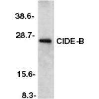 CIDE B antibody