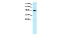 HNF1 beta antibody, N-term