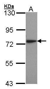 Lysyl-tRNA synthetase antibody