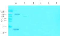 CGRP antibody