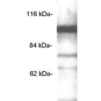 PDE6C antibody