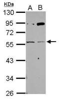 AChR gamma antibody
