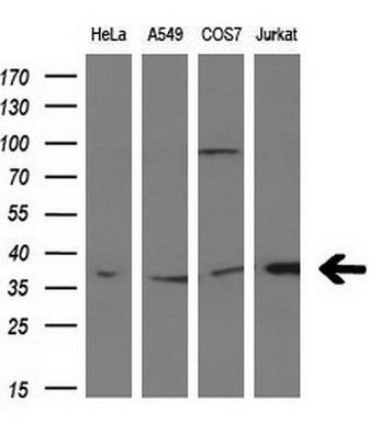 MCL1 antibody [2E11]