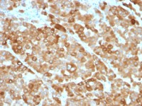 Tyrosinase antibody [OCA1/812]